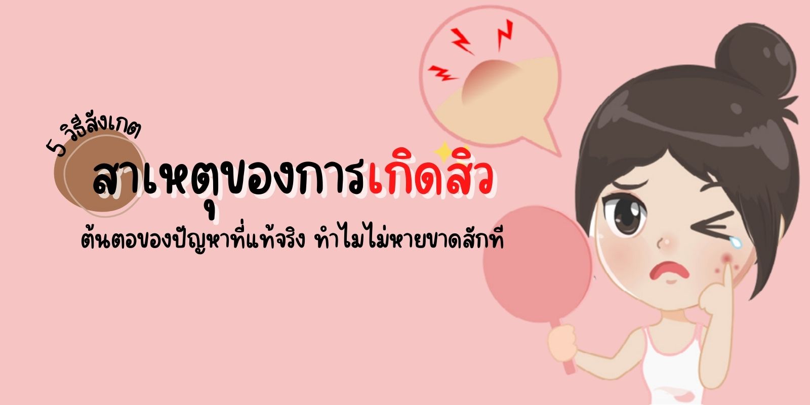 5 วิธีสังเกต สาเหตุของการเกิดสิว