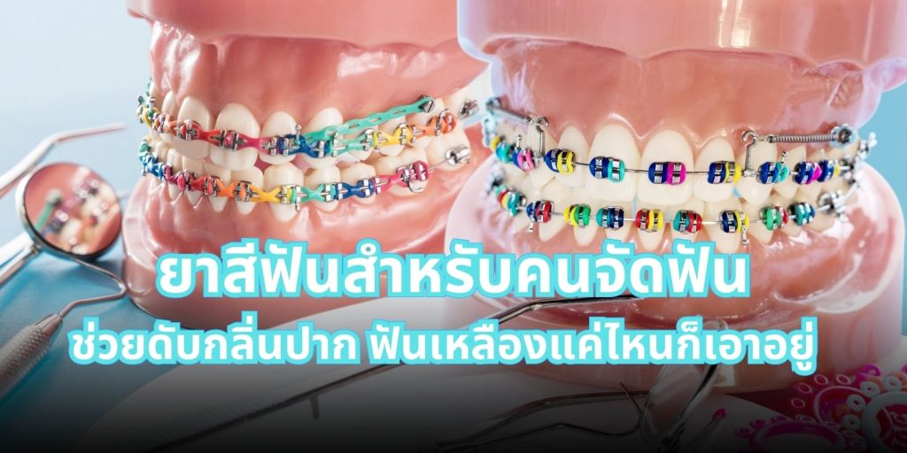 6 ยาสีฟัน สำหรับคนจัดฟัน