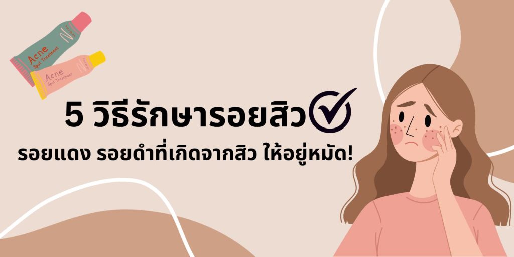 5 วิธีรักษารอยสิว รอยแดง รอยดำที่เกิดจากสิว