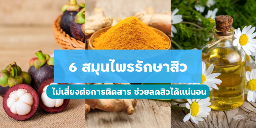 แนะนำ 6 สมุนไพรรักษาสิว ไม่เสี่ยงต่อการติดสาร ช่วยลดสิวได้แน่นอน