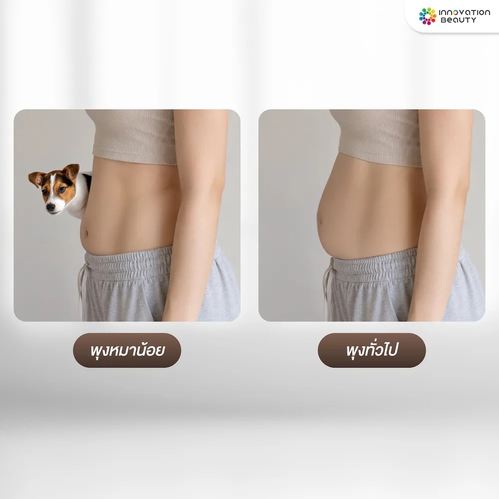 Hormonal Belly (พุงหมาน้อย)